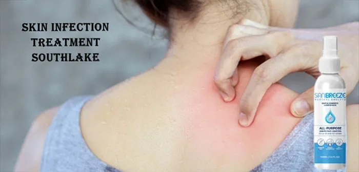 Hypochlorous Acid Disinfectant: In Vitro Bactericidal Efficacy on Common Pathogens of Skin and Soft Tissue Infections